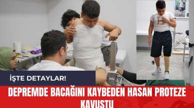 Depremde Bacağını Kaybeden Hasan Proteze Kavuştu