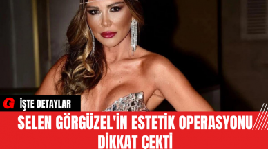 Selen Görgüzel'in Estetik Operasyonu Dikkat Çekti