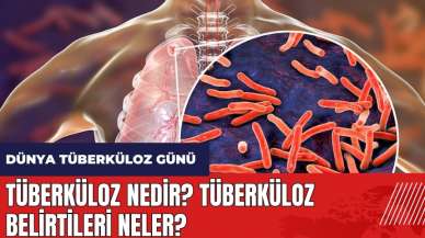 Tüberküloz nedir? Tüberküloz belirtileri neler?