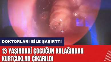 13 yaşındaki çocuğun kulağından kurtçuklar çıkarıldı