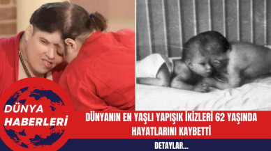 Dünyanın En Yaşlı Yapışık İkizleri 62 Yaşında Hayatlarını Kaybetti