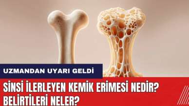 Sinsi ilerleyen kemik erimesi nedir? Belirtileri neler?