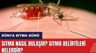 Sıtma nasıl bulaşır? Sıtma belirtileri nelerdir?