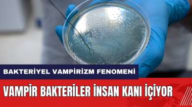 Vampir bakteriler insan kanı içiyor! Bakteriyel Vampirizm fenomeni nedir?