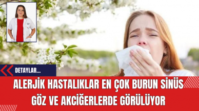 Alerjik hastalıklar en çok burun sinüs göz ve akciğerlerde görülüyor