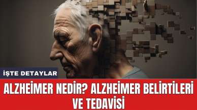 Alzheimer Nedir? Alzheimer Belirtileri ve Tedavisi