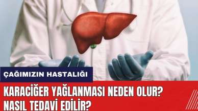 Çağımızın hastalığı karaciğer yağlanması neden olur? Nasıl tedavi edilir?