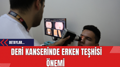 Deri Kanserinde Erken Teşhisi Önemi