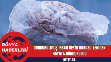 Dondurulmuş İnsan Beyin Dokusu Yeniden Hayata Döndürüldü