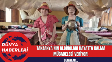 Tanzanya'nın Albinoları Hayatta Kalma Mücadelesi Veriyor!