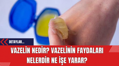 Vazelin Nedir? Vazelinin Faydaları Nelerdir Ne İşe Yarar?