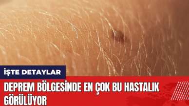 Deprem bölgesinde en çok bu hastalık görülüyor