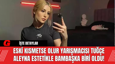 Eski Kısmetse Olur Yarışmacısı Tuğçe Aleyna Estetikle Bambaşka Biri Oldu!