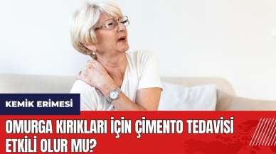 Kemik erimesinde omurga kırıkları için çimento tedavisi etkili olur mu?