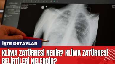 Klima zatürresi nedir? Klima zatürresi belirtileri nelerdir?