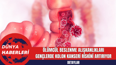 Ölümcül Beslenme Alışkanlıkları Gençlerde Kolon Kanseri Riskini Artırıyor