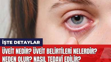 Üveit nedir? Üveit belirtileri nelerdir? Neden olur? Nasıl tedavi edilir?