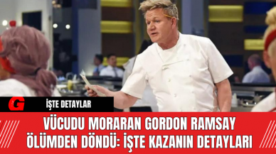 Vücudu Moraran Gordon Ramsay Ölümden Döndü: İşte Kazanın Detayları