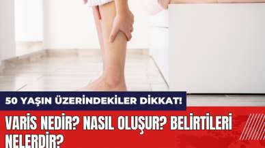 50 yaşın üzerindekiler dikkat! Varis nedir? Nasıl oluşur? Belirtileri nelerdir?