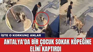 Antalya'da bir çocuk sokak köpeğine elini kaptırdı