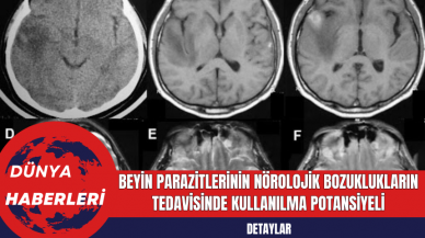 Beyin Parazitlerinin Nörolojik Bozuklukların Tedavisinde Kullanılma Potansiyeli