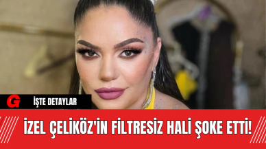 İzel Çeliköz'in Filtresiz Hali Şoke Etti!