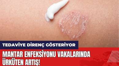 Mantar enfeksiyonu vakalarında ürküten artış! Tedaviye direnç gösteriyor