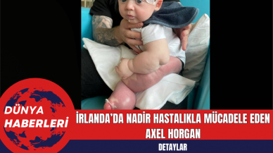 İrlanda’da Nadir Hastalıkla Mücadele Eden Axel Horgan