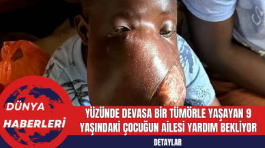 Yüzünde Devasa Bir Tümörle Yaşayan 9 Yaşındaki Çocuğun Ailesi Yardım Bekliyor