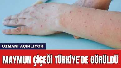 Maymun Çiçeği Türkiye'de Görüldü