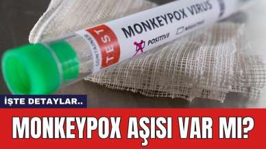 Monkeypox aşısı var mı?