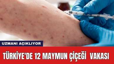 Türkiye'de 12 maymun çiçeği vakası