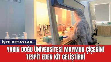 Yakın Doğu Üniversitesi maymun çiçeğini tespit eden kit geliştirdi