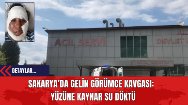 Sakarya’da Gelin Görümce Kavgası: Yüzüne Kaynar Su Döktü