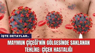 Maymun Çiçeği'nin Gölgesinde Saklanan Tehlike: Çiçek Hastalığı