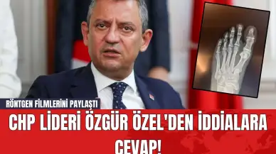 CHP Lideri Özgür Özel'den İddialara Cevap! Röntgen Filmlerini Paylaştı