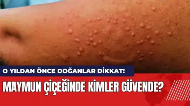 Maymun çiçeğinde kimler güvende? O yıldan önce doğanlar dikkat!