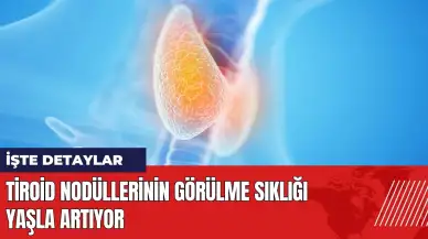 Tiroid nodüllerinin görülme sıklığı yaşla artıyor