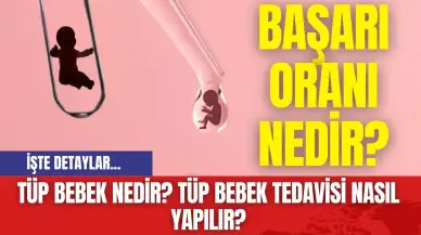 Tüp Bebek Nedir? Tüp Bebek Tedavisi Nasıl Yapılır? Başarı oranı nedir?