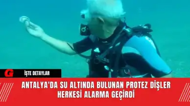 Antalya'da Su Altında Bulunan Protez Dişler Herkesi Alarma Geçirdi