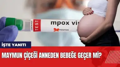 Maymun çiçeği anneden bebeğe geçer mi?