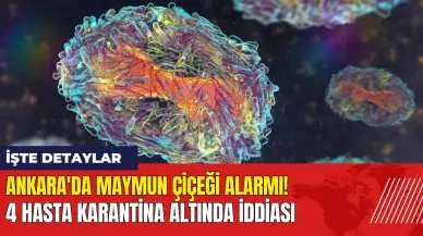 Ankara'da maymun çiçeği alarmı: 4 hasta karantina altında iddiası