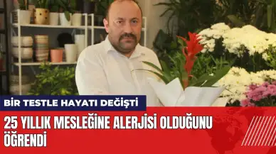 Bir testle hayatı değişti: 25 yıllık mesleğine alerjisi varmış!