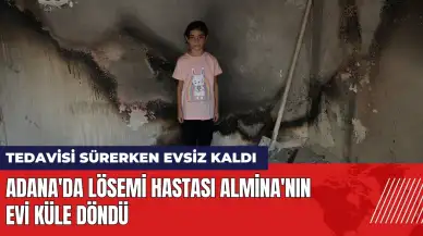 Adana'da lösemi hastası küçük Almina'nın evi yandı