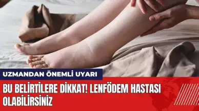 Bu belirtilere dikkat! Lenfödem hastası olabilirsiniz