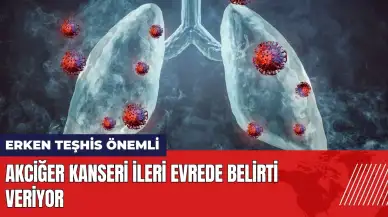 Akciğer kanseri ileri evrede belirti veriyor