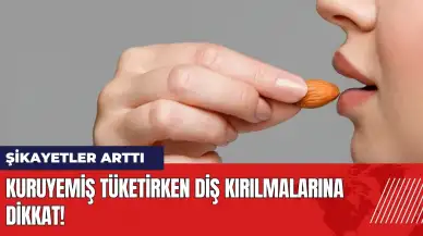 Kuruyemiş tüketirken diş kırılmalarına dikkat! Şikayetler arttı