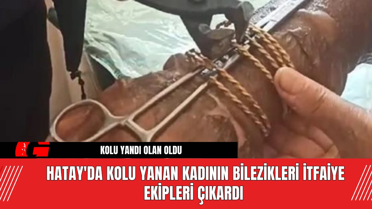 Hatay'da kolu yanan kadının bilezikleri itfaiye ekipleri çıkardı