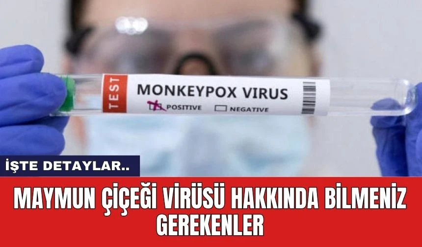 Maymun Çiçeği Virüsü Hakkında Bilmeniz Gerekenler