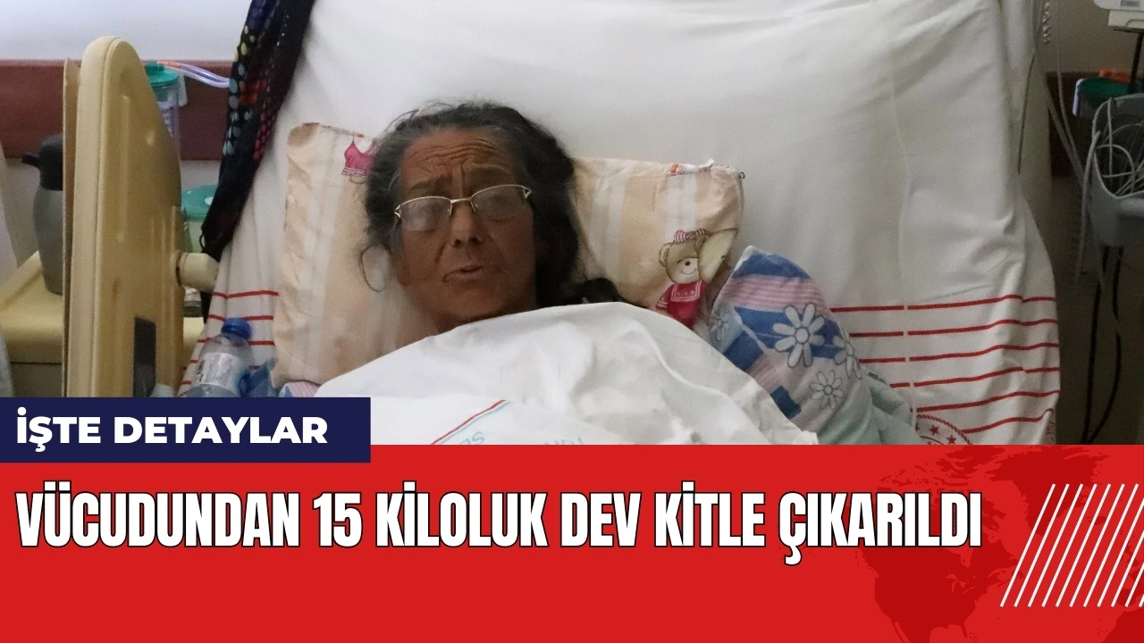 Vücudundan 15 kiloluk dev kitle çıkarıldı